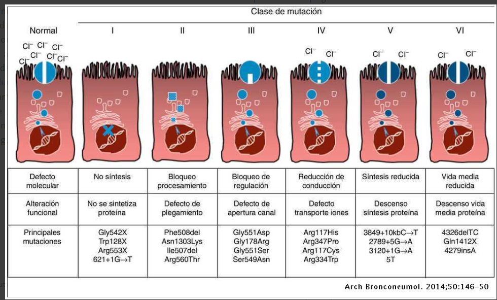 Suero salino hipertónico para Fibrosis Quística 